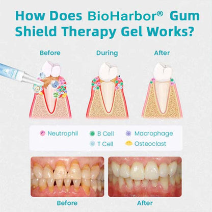 BioHarbor® Gum Shield Therapy Gel