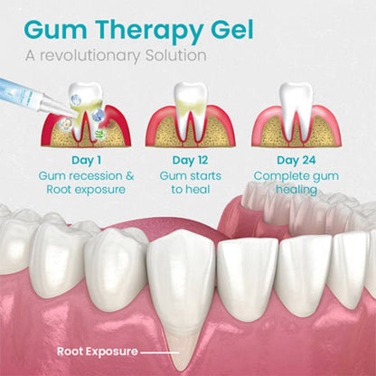 BioHarbor® Gum Shield Therapy Gel