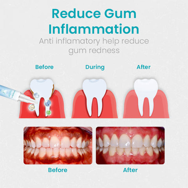 BioHarbor® Gum Shield Therapy Gel